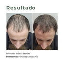 Nano Repair Growth Factor Anti Queda  Crescimento Capilar
