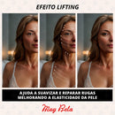 Adesivos Anti Rugas para Rosto Modelo:2 Peças (Boca)