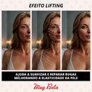 Adesivos Anti Rugas para Rosto Modelo:5 Peças