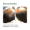 Nano Repair Growth Factor Anti Queda  Crescimento Capilar